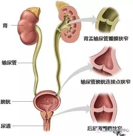 「医学美图」泌尿系统——10分钟搞定