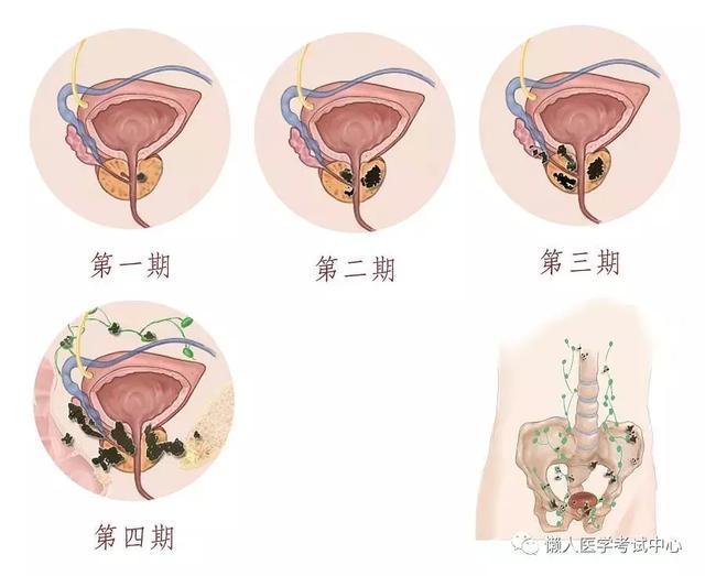 「医学美图」泌尿系统——10分钟搞定