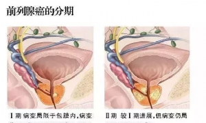 「医学美图」泌尿系统——10分钟搞定