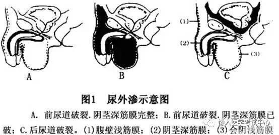 「医学美图」泌尿系统——10分钟搞定