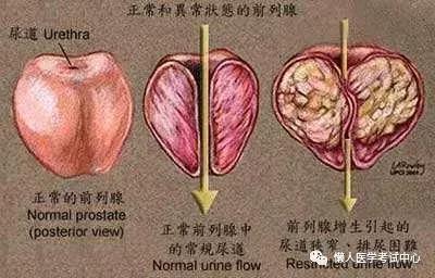 「医学美图」泌尿系统——10分钟搞定