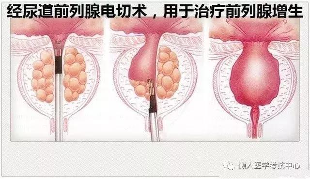 「医学美图」泌尿系统——10分钟搞定