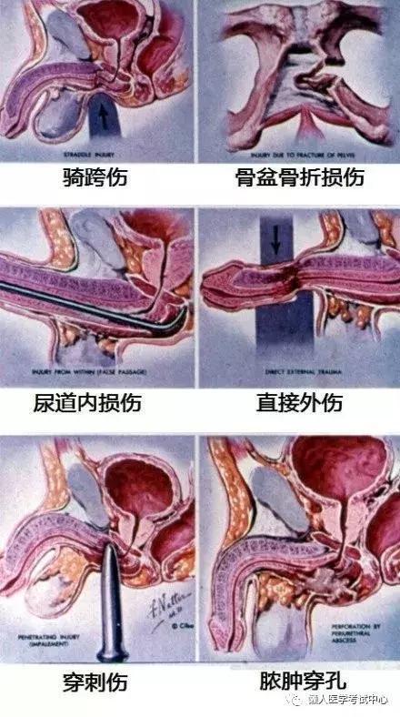 「医学美图」泌尿系统——10分钟搞定