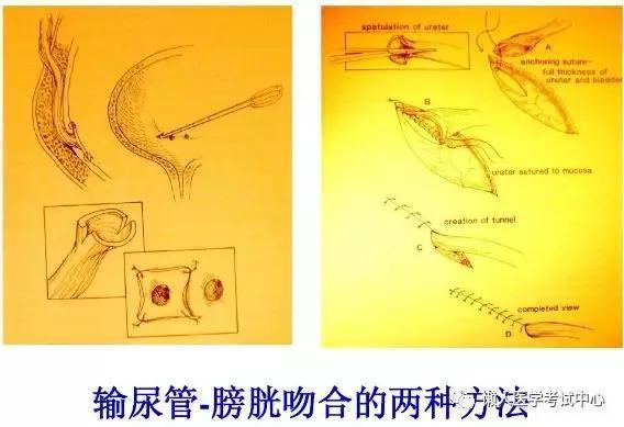 「医学美图」泌尿系统——10分钟搞定